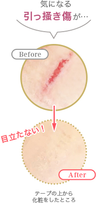 切り傷・ひっかき跡の上からメイク 利用前利用後
